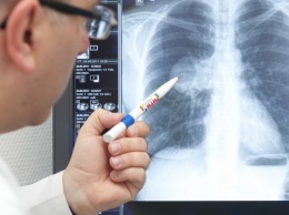 Медики бьют тревогу: людей "выкашивает" новый вид пневмонии