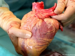 Как в Германии хотят решить проблему с органами для трансплантации