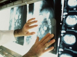 Сигналы, которые нельзя упускать: онкохирург назвал первые симптомы рака