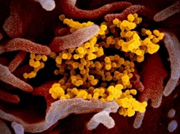 Коронавирус в мире: 77 тысяч случаев заболевания, умерло 2 464 человека