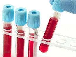 Онкологи назвали самую устойчивую к раку группу крови