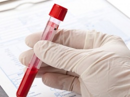 Простой анализ крови распознает рак легких заранее