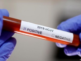 Экспресс-тест на коронавирус: как он работает и когда его надо делать