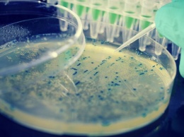 Патогенные микроорганизмы выявили в молоке ставропольского производителя