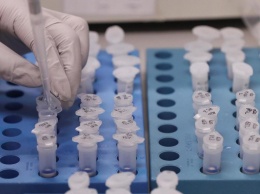 В Днепре в инфекционную больницу закупают новое оборудование для борьбы с коронавирусом