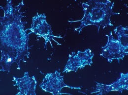 Ученые раскрыли механизм, способствующий метастазированию рака