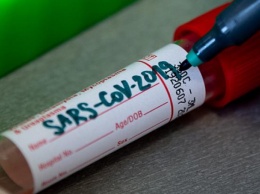 Сингапурские ученые создали тест для выявления коронавируса за пять минут