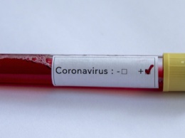 На Харьковщине лабораторно подтвердили первый случай коронавируса