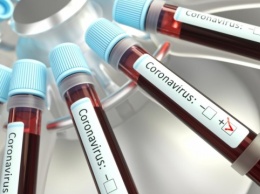 На Одесчине у 14 человек подтвердили коронавирус, еще 124 подозрения проверяют