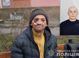 Амфетамин ''съел'' молодого украинца за 2 года: зубы выпали, челюсть сгнила. Фото 18+