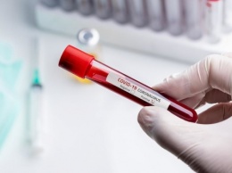Польские ученые исследуют влияние вакцины от туберкулеза на коронавирус