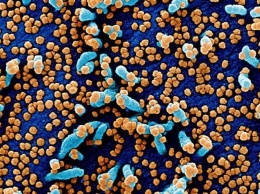 Американские ученые обнаружили еще шесть симптомов коронавируса