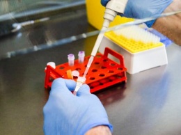 В Житомирской области из-за перегруженности лаборатории ограничат тестирование на коронавирус (обновлено)