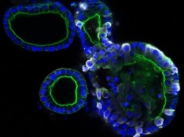 Коронавирус поражает не только легкие, но и кишечник - исследование