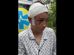 Били лопатой и пилой: 17-летний парень из Харькова раскрыл новые детали о пытках