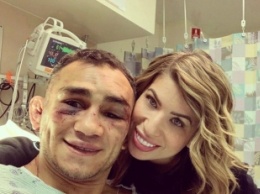На лице нет живого места: Фергюсон после поражения от Гэтжи ужаснул фотографией из больницы