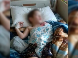 В Днепре в парке "Зеленый Гай" 6-летний мальчик сломал руку на батуте