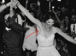 Свадебная фотография помогла невесте выявить рак