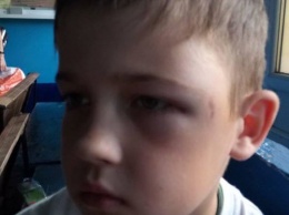 На Днепропетровщине подростки жестоко избили 9-летнего ребенка за то, что "плохо с ними дружил"