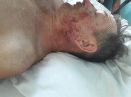 В Акимовском районе из-за черешни избили пенсионера