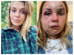 Мужчина избил и пытался изнасиловать пассажирку поезда «Мариуполь - Киев» (ФОТО, ВИДЕО)