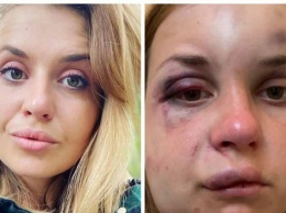 Нападение на женщину в купе: "Укрзализныця" уволит ряд сотрудников