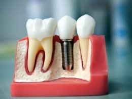 Удаление зубов мудрости: особенности процесса