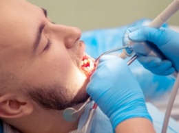 Правда ли, что зубной камень может привести к выпадению зубов