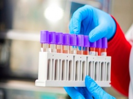 В Никополе выявил новый случай заражения коронавирусом