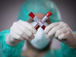 Запорожский областной центр МОЗ прекращает проводить платное тестирование на коронавирус