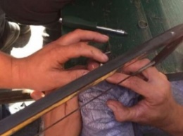В Днепре трое спасателей снимали кольцо с пальца подростка (фото)