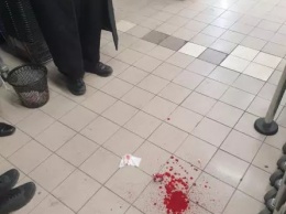 В супермаркете "АТБ" в Умани напали на хасида и разбили ему нос. Фото