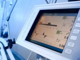 Для киевских больниц отремонтировали почти сотню аппаратов ИВЛ