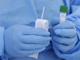 В Украине за сутки сделали более 63,7 тысячи тестов на коронавирус