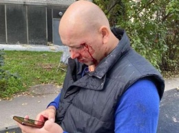 В Киеве неизвестные избили ветерана АТО и его жену