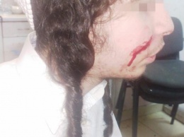 В Умани неизвестные напали с ножом на хасидов-подростков. Фото