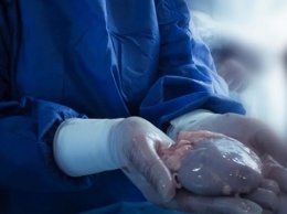Во Львове создали кафедру хирургии и трансплантологии