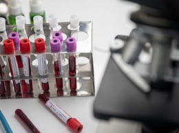 "Миллион флаконов": Австралия начала производство вакцины от COVID-19