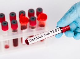 Массовое тестирование может помочь "убить" COVID-19 за полтора месяца - исследование