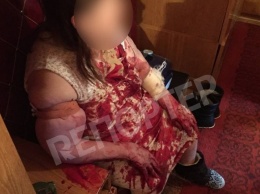 Кровь - рекой: в Днепре полуголая дочь напала а маму (ФОТО 18+)