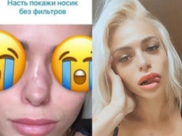 Звезда «Дома-2» Анастасия Балинская показала испорченный ринопластикой нос