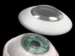 В Израиле врачи впервые успешно пересадили искусственные роговицы, вернув зрение слепому