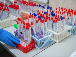 Где и сколько стоит: в каких лабораториях Харькова можно сдать ПЦР и ИФА тест на коронавирус