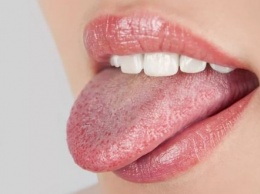 Бюллетень здоровья: что об организме расскажет цвет вашего языка
