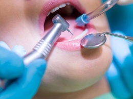 Перечень стоматологических услуг, которые днепряне в 2021 году смогут получить бесплатно