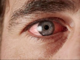 Названы лекарственные препараты, вызывающие синдром сухого глаза