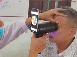 Samsung превратила старые смартфоны Galaxy в прибор для диагностики заболеваний глаз