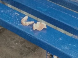 На одной из остановок Херсонщины кто-то потерял зубы