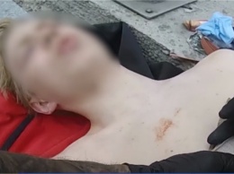 Накатался: в центре Киева подросток упал с электросамоката на штырь