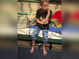 В Кривом Роге нелюдь посадил на цепь 7-летнего сына своей сожительницы